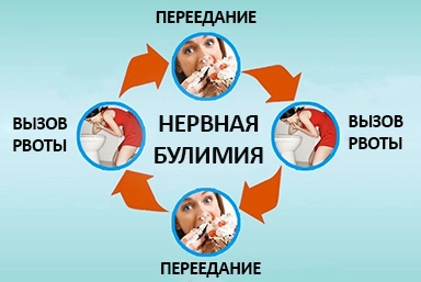 Лечение булимии в Яшкино